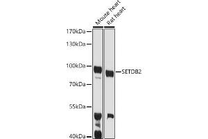 Western blot analysis of extracts of various cell lines, using SETDB2 antibody (ABIN6131576, ABIN6147657, ABIN6147658 and ABIN6223256) at 1:1000 dilution. (SETDB2 antibody  (AA 1-280))