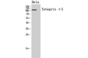 Western Blotting (WB) image for anti-Integrin, alpha 5 (ITGA5) (Internal Region) antibody (ABIN3188019) (ITGA5 antibody  (Internal Region))