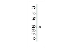 Antibody is used in Western blot to detect IL29 in Jurkat cell lysate. (IL29 antibody  (AA 54-85))
