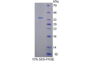 SDS-PAGE (SDS) image for Geminin, DNA Replication Inhibitor (GMNN) (AA 8-206) protein (His tag) (ABIN4989312) (Geminin Protein (AA 8-206) (His tag))