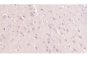 Immunohistochemistry (IHC) image for anti-Transferrin Receptor (p90, CD71) (TFRC) (AA 567-744) antibody (ABIN7426211)