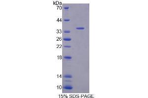 Image no. 1 for Calcyphosine 2 (CAPS2) (AA 49-287) protein (His tag) (ABIN5665143) (Calcyphosine 2 Protein (CAPS2) (AA 49-287) (His tag))