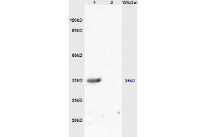 Lane 1:mouse kidney lysates Lane 2: mouse brain lysates probed with Anti-MC-1R/MC1 Receptor Polyclonal Antibody, Unconjugated (ABIN686287) at 1:200 in 4 °C. (MC1 Receptor antibody  (AA 271-317))