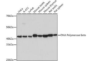 Western blot analysis of extracts of various cell lines, using DNA Polymerase beta Rabbit mAb (ABIN7269456) at 1:1000 dilution. (POLB antibody)