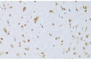 Immunohistochemistry of paraffin-embedded Mouse brain using CDKN1A Polyclonal Antibody at dilution of 1:100 (40x lens). (p21 antibody)
