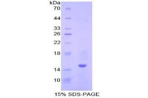 SDS-PAGE analysis of Human Cystatin B Protein. (CSTB Protein)