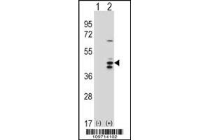 Western blot analysis of RCL1 using rabbit polyclonal RCL1 Antibody using 293 cell lysates (2 ug/lane) either nontransfected (Lane 1) or transiently transfected (Lane 2) with the RCL1 gene. (RCL1 antibody  (N-Term))