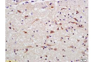 Formalin-fixed and paraffin embedded rat brain labeled with Rabbit Anti OPA1 Polyclonal Antibody, Unconjugated (ABIN1387244) at 1:200 followed by conjugation to the secondary antibody and DAB staining (OPA1 antibody  (AA 651-750))