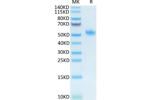 Osteopontin Protein (AA 17-294) (His tag)