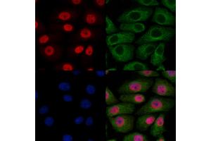 ABIN7094092 and ABIN7098136 staining HepG2 cells by IF/ICC.
