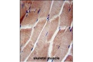 RPL5 Antibody (N-term) (ABIN653209 and ABIN2842750) immunohistochemistry analysis in formalin fixed and paraffin embedded human skeletal muscle followed by peroxidase conjugation of the secondary antibody and DAB staining. (RPL5 antibody  (N-Term))