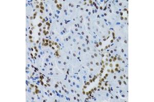Immunohistochemistry (Paraffin-embedded Sections) (IHC (p)) image for anti-Nuclear Factor of kappa Light Polypeptide Gene Enhancer in B-Cells 2 (NFKB2) (AA 690-899) antibody (ABIN3017388)