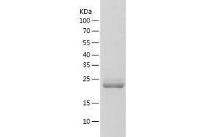 Western Blotting (WB) image for MOB Kinase Activator 1B (MOB1B) (AA 1-216) protein (His tag) (ABIN7287740) (MOBKL1A Protein (AA 1-216) (His tag))