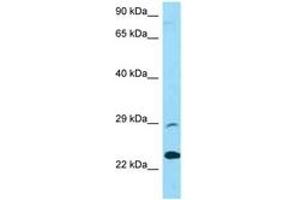 Image no. 1 for anti-Protease, serine, 58 (PRSS58) (AA 122-171) antibody (ABIN6748388) (PRSS58 antibody  (AA 122-171))