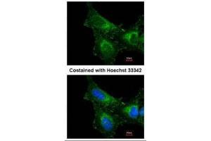 ICC/IF Image Immunofluorescence analysis of methanol-fixed HeLa, using PRX I, antibody at 1:200 dilution. (Peroxiredoxin 1 antibody)