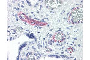Anti-RND3 antibody IHC of human placenta. (RND3 antibody  (AA 1-245))