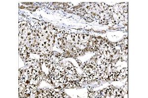 IHC analysis of EHMT2/G9A using anti-EHMT2/G9A antibody (ABIN7602084).