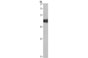 Western Blotting (WB) image for anti-Calumenin (CALU) antibody (ABIN2429669)