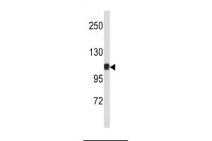 Western blot analysis of CTNA1 antibody (N-term) (ABIN390505 and ABIN2840861) in mouse bladder tissue lysates (35 μg/lane). (CTNNA1 antibody  (N-Term))