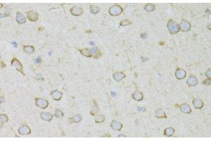 Immunohistochemistry of paraffin-embedded Rat brain using RPL13 Polyclonal Antibody at dilution of 1:100 (40x lens). (RPL13 antibody)