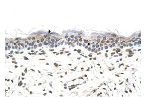 FTCD antibody was used for immunohistochemistry at a concentration of 4-8 ug/ml to stain Squamous epithelial cells (arrows) in Human Skin. (FTCD antibody  (N-Term))