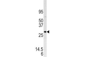 Western Blotting (WB) image for anti-Dual Specificity Phosphatase 3 (DUSP3) antibody (ABIN3003774)