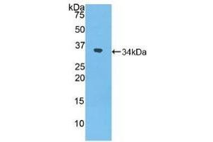 Detection of Recombinant NXN, Mouse using Polyclonal Antibody to Nucleoredoxin (NXN) (NXN antibody  (AA 167-435))