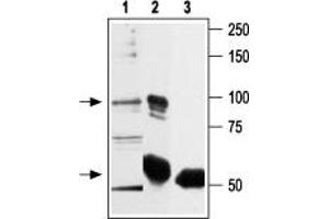 Immunoprecipitation of rat basophilic leukemia (RBL) lysate: - 1. (TRPV2 antibody  (C-Term, Intracellular))