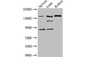 Western Blot Positive WB detected in: Mouse spleen tissue, Mouse lung tissue, Mouse kidney tissue All lanes: NOS1 antibody at 3 μg/mL Secondary Goat polyclonal to rabbit IgG at 1/50000 dilution Predicted band size: 161, 149, 126, 44, 165 kDa Observed band size: 161, 126, 92 kDa (NOS1 antibody  (AA 655-875))