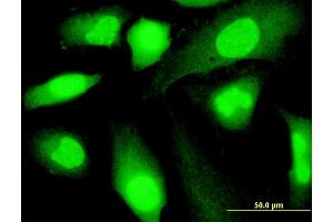 Immunofluorescence of monoclonal antibody to SP140 on HeLa cell. (SP140 antibody  (AA 504-612))