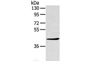 Western Blot analysis of A431 cell using TNIP2 Polyclonal Antibody at dilution of 1:500 (TNIP2 antibody)