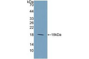 Detection of Recombinant IL9, Human using Polyclonal Antibody to Interleukin 9 (IL9) (IL-9 antibody  (AA 19-144))