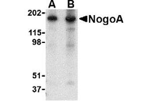 Western Blotting (WB) image for anti-Reticulon 4 (RTN4) (N-Term) antibody (ABIN1031486) (Reticulon 4 antibody  (N-Term))