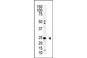 Western blot analysis of SENP8 polyclonal antibody (ABIN388073 and ABIN2845796) in mouse spleen lysate. (SENP8 antibody  (N-Term))