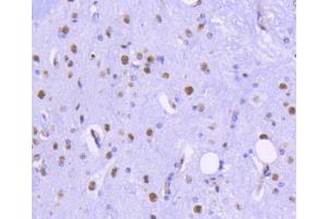 Paraformaldehyde-fixed, paraffin embedded mouse spinal cord, Antigen retrieval by boiling in sodium citrate buffer (pH6) for 15min, Block endogenous peroxidase by 3% hydrogen peroxide for 30 minutes, Blocking buffer at 37°C for 20min, Antibody incubation with HDAC2 (3B7) Monoclonal Antibody  at 1:50 overnight at 4°C, followed by a conjugated secondary and DAB staining.