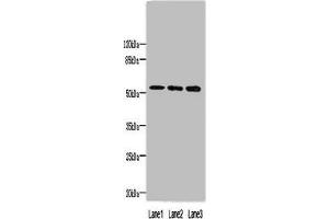 Western blot All lanes: MINDY1 antibody at 8 μg/mL Lane 1: Mouse liver tissue Lane 2: A549 whole cell lysate Lane 3: HepG2 whole cell lysate Secondary Goat polyclonal to rabbit IgG at 1/10000 dilution Predicted band size: 52, 37, 57, 42 kDa Observed band size: 52 kDa (Ubiquitin Carboxyl-Terminal Hydrolase MINDY-1 (MINDY1) (AA 3-278), (C-Term) antibody)