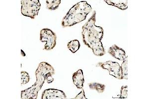 IHC analysis of SP6 using anti-SP6 antibody (ABIN5692945). (SP6 antibody)