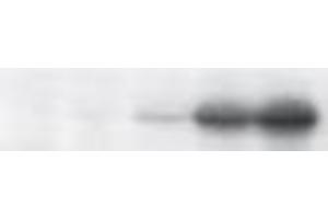 Western Blotting (WB) image for anti-Tumor Protein P53 (TP53) (pSer46) antibody (ABIN3201005) (p53 antibody  (pSer46))