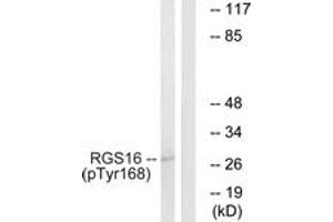 Western blot analysis of extracts from COS7 cells treated with heat shock, using RGS16 (Phospho-Tyr168) Antibody. (RGS16 antibody  (pTyr168))