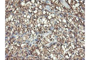Image no. 2 for anti-Glutamyl Aminopeptidase (Aminopeptidase A) (ENPEP) antibody (ABIN1498029) (ENPEP antibody)