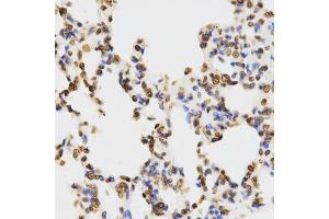 Immunohistochemistry of paraffin-embedded rat lung using DiMethyl-Histone H3-K9 antibody (ABIN1872998) at dilution of 1:200 (40x lens). (Histone 3 antibody  (H3K9me2))