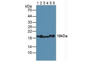 Figure. (MYL2 antibody  (AA 2-159))