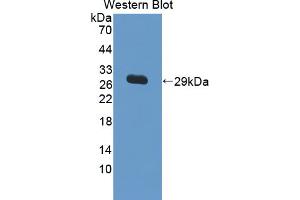 Western blot analysis of the recombinant protein. (IL17RC antibody  (AA 257-477))