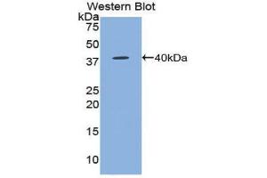 Western Blotting (WB) image for anti-Chemokine (C-C Motif) Ligand 5 (CCL5) (AA 24-91) antibody (ABIN1172331) (CCL5 antibody  (AA 24-91))