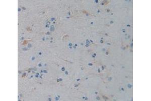 Figure. (Cholesterol Esterase antibody  (AA 117-361))