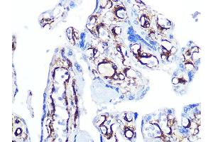Immunohistochemistry of paraffin-embedded human placenta using Caldesmon Rabbit mAb (ABIN7266024) at dilution of 1:100 (40x lens). (Caldesmon antibody)