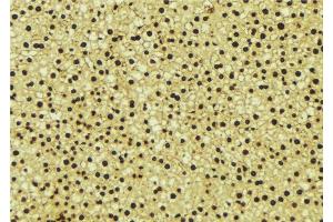 ABIN6276646 at 1/100 staining Mouse liver tissue by IHC-P.