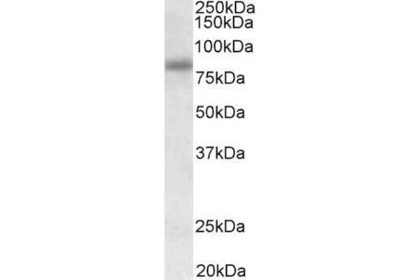 SDCCAG8 antibody  (Internal Region)