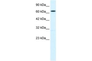 Western Blotting (WB) image for anti-Potassium Intermediate/small Conductance Calcium-Activated Channel, Subfamily N, Member 2 (KCNN2) antibody (ABIN2461098) (KCNN2 antibody)