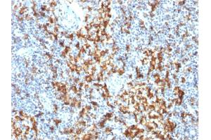 Immunohistochemistry (IHC) image for anti-CD163 (CD163) (AA 43-196) antibody (ABIN6941114)